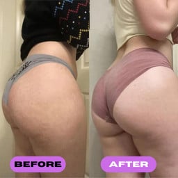 ELECTRO ESTIMULADOR Y TONIFICADOR DE GLUTEOS